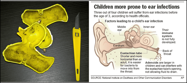 ear infections affect kintetic chain development