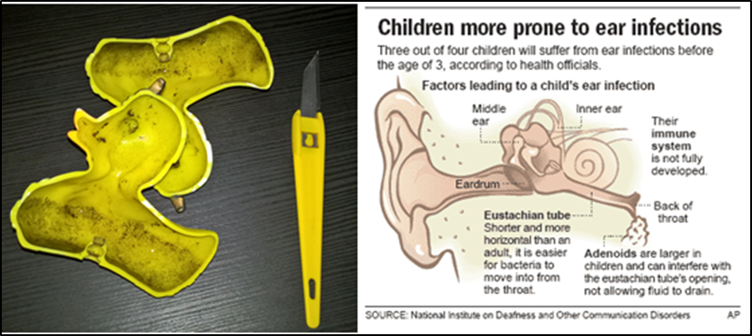 gross motor skills