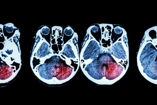 Forbrain Scientific Study